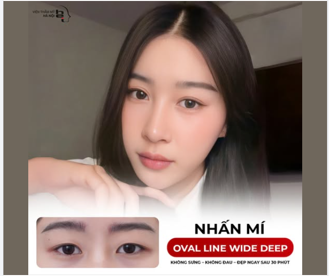 NHẤN MÍ OVAL LINE WIDE DEEP