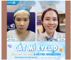 HAI MÍ RÕ NÉT - TỰ TIN VỚI DIỆN MẠO MỚI