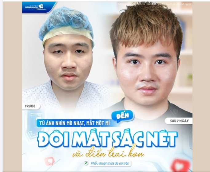 ĐÔI MẮT SẮC NÉT GIÚP BẠN ĐIỂN TRAI HƠN