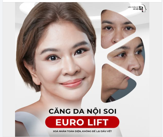 CĂNG DA NỘI SOI EURO LIFT  60 PHÚT "BACK TO 20" – TRẺ NGAY 10 TUỔI