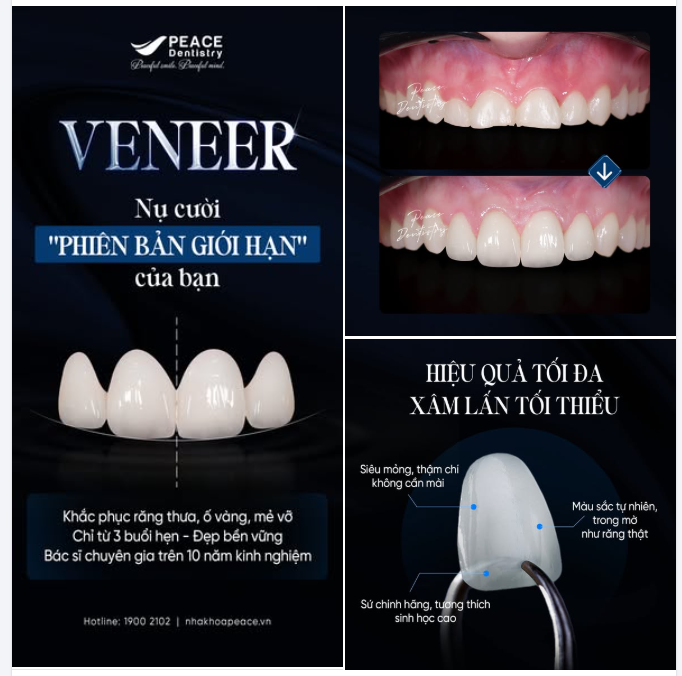 BẠN XỨNG ĐÁNG CÓ MỘT NỤ CƯỜI ĐẸP HƠN