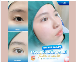 SAY BYE MÍ LÓT – TẠO HÌNH MẮT HAI MÍ TỰ NHIÊN CUỐN HÚT