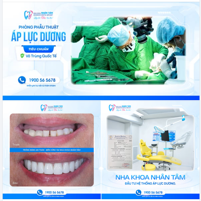 TẠI SAO PHẢI CẤY GHÉP IMPLANT TRONG PHÒNG ÁP LỰC DƯƠNG?