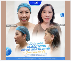 Có những dấu vết của thời gian không chỉ nằm trên làn da…Mà còn in hằn trong ánh nhìn thiếu tự tin, trong từng khoảnh khắc ngại ngùng khi soi gương.