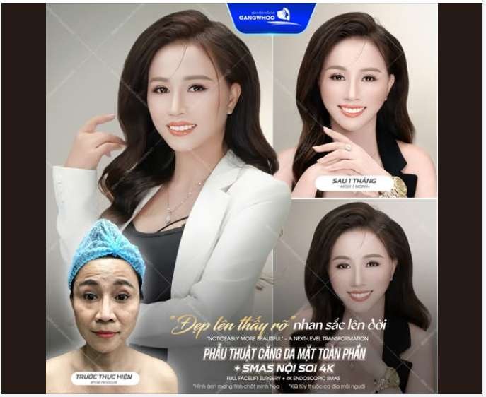 Bạn có tin vào một "phép màu" có thể xóa sạch 10 năm dấu vết thời gian trên gương mặt chỉ sau một lần thực hiện?