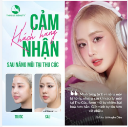 Không phải ai nâng mũi lần đầu cũng thành công…