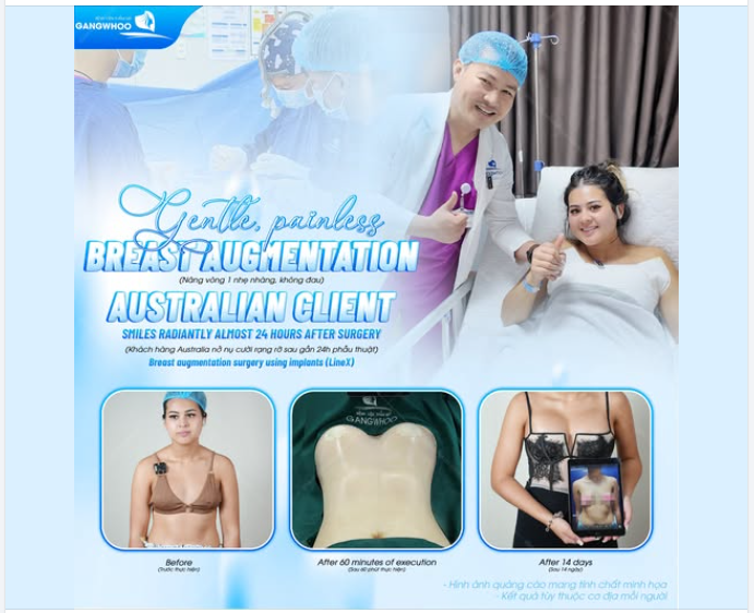 NÂNG VÒNG 1 NHẸ NHÀNG, KHÔNG ĐAU - KHÁCH HÀNG AUSTRALIA NỞ NỤ CƯỜI RẠNG RỠ SAU GẦN 24H PHẪU THUẬT