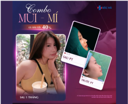 BẠN CÓ BIẾT 70% NHAN SẮC TRÊN GƯƠNG MẶT PHỤ THUỘC VÀO DÁNG MŨI?