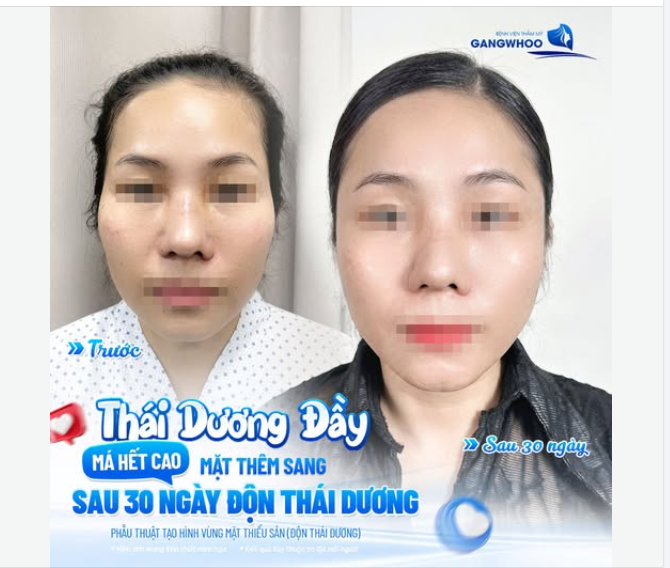 THÁI DƯƠNG ĐẦY - HẾT MÁ CAO