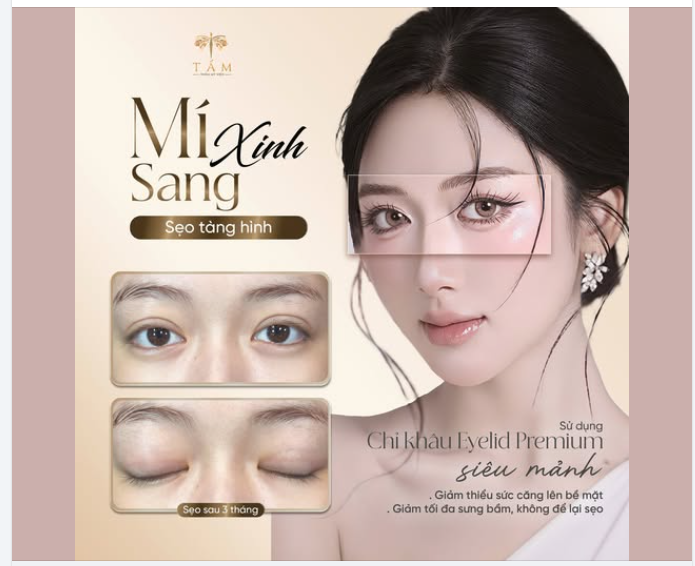 30/4 – 1/5 | THỜI ĐIỂM VÀNG ĐỂ “LỘT XÁC” NHAN SẮC TẠI THẨM MỸ VIỆN TẤM