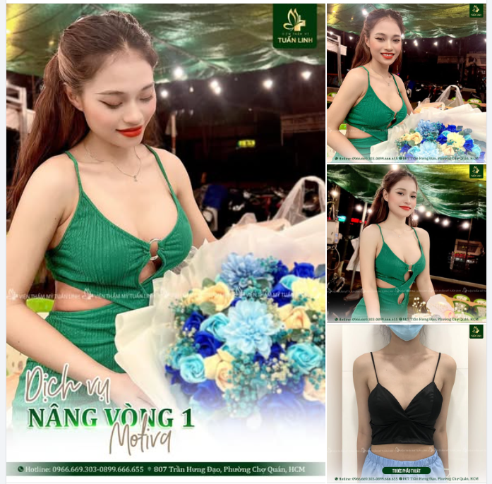 NÂNG VÒNG 1 TÚI MOTIVA – CHẠM CHUẨN ĐẸP TỰ NHIÊN, MỀM MẠI NHƯ THẬT