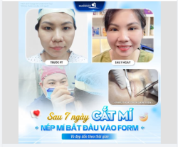 NẾP MÍ BẮT ĐẦU VÀO FORM VÀ ĐẸP DẦN THEO THỜI GIAN
