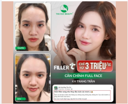 10 điểm không có nhưng cho Filler TC - CHỈ TỪ 3TR/CC!