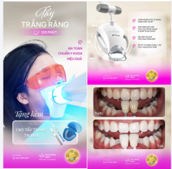 BẬT "TONE" RĂNG Ố VÀNG SAU 120 PHÚT TẨY TRẮNG AN TOÀN, CHUẨN Y KHOA