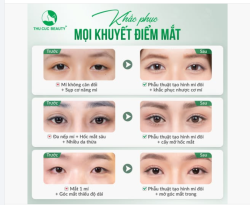 Không phải mắt quá xấu…  Mà là bạn đang gặp quá nhiều khuyết điểm cùng lúc: