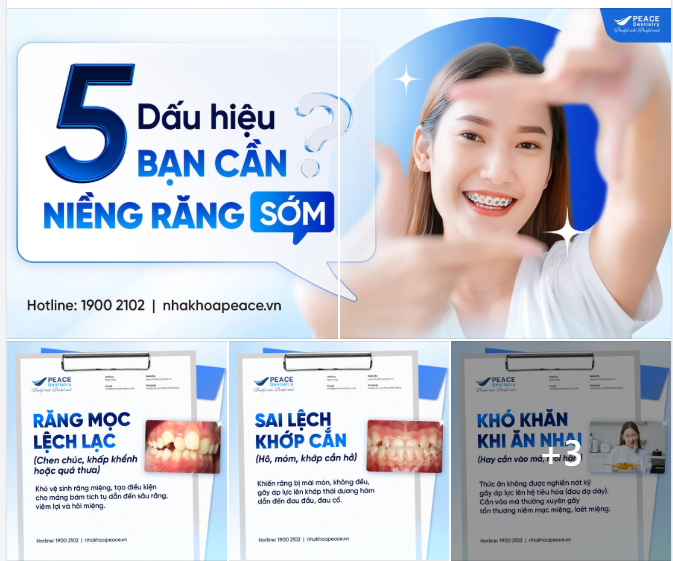 Dành 30s kiểm tra nhanh bạn có cần phải niềng răng không?