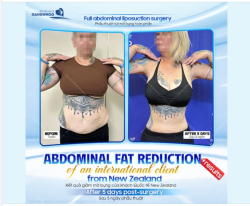 Trước kia cô thường ưu tiên trang phục rộng rãi để cảm thấy thoải mái hơn. Sau khi trải nghiệm dịch vụ cô chia sẻ rằng mình cảm nhận vùng bụng gọn gàng, đi đứng nhẹ nhàng hơn.