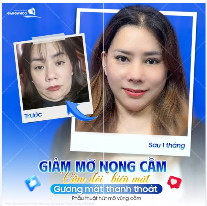 TỰ TIN TỎA SÁNG VỚI GƯƠNG MẶT THANH THOÁT