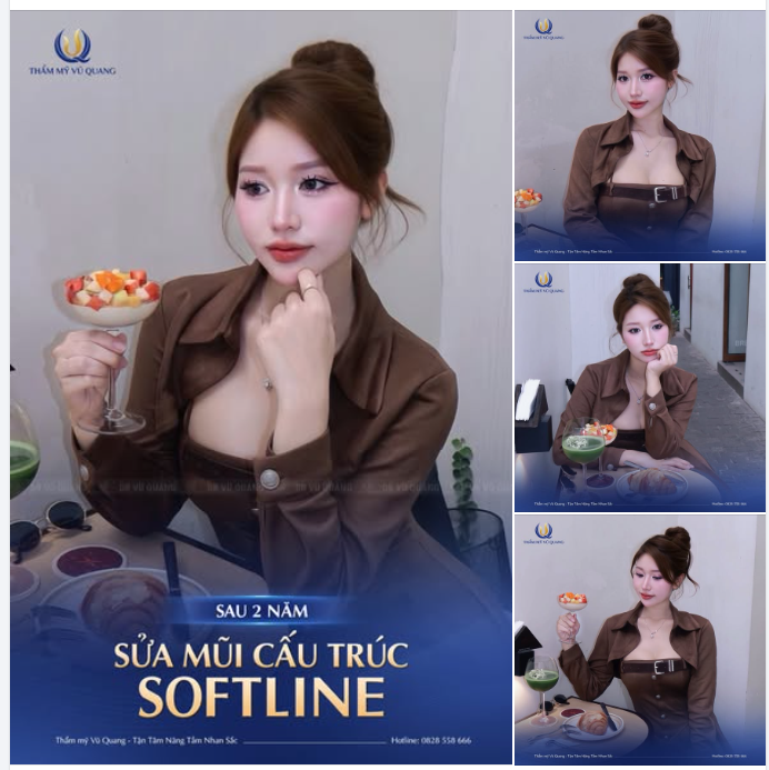 Đã nâng mũi rồi, chẳng ai muốn phải sửa đi sửa lại nhiều lần