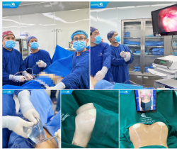 60 PHÚT BIẾN HÓA VÒNG 1 SAU SINH - TỪ CHẢY XỆ, PHÌ ĐẠI ĐẾN CẶP GÒ BỒNG ĐẢO TRÒN ĐẦY