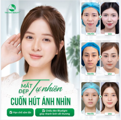 NHỮNG CA CẮT MÍ THÀNH CÔNG TẠI THU CÚC