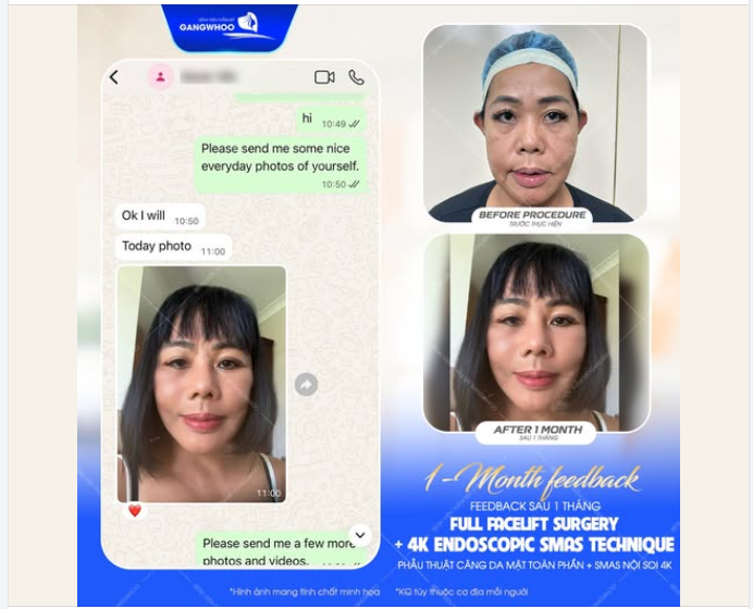"Đến Việt Nam lần này, quyết định đúng đắn nhất của mình chính là ghé Bệnh viện thẩm mỹ Gangwhoo!"Mrs.P - Úc - 57 tuổi chia sẻ.