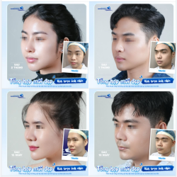 ​​​​​​​ Bí quyết để nhan sắc tự động "phát sáng" giữa đám đông là gì? Chính là sở hữu một chiếc mũi chuẩn tỷ lệ vàng!