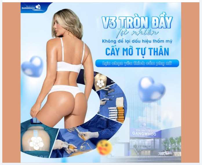 CẤY MỠ VÒNG 3 – XU HƯỚNG LÀM ĐẸP “LÊN NGÔI” CỦA PHÁI ĐẸP