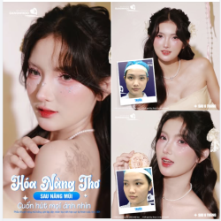 Nhìn khí chất ngọt ngào, trong trẻo này, ít ai biết 6 tháng trước, cô bạn từng e ngại vì dáng mũi thấp làm lu mờ đi nụ cười rạng rỡ.