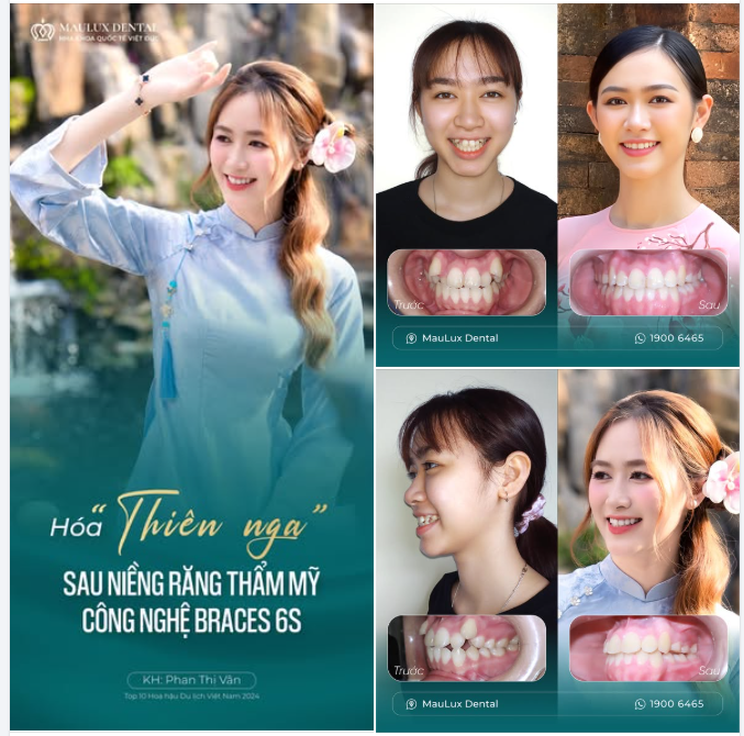 PHAN VÂN – NIỀNG NỤ CƯỜI, “BẬT MODE” TỰ TIN