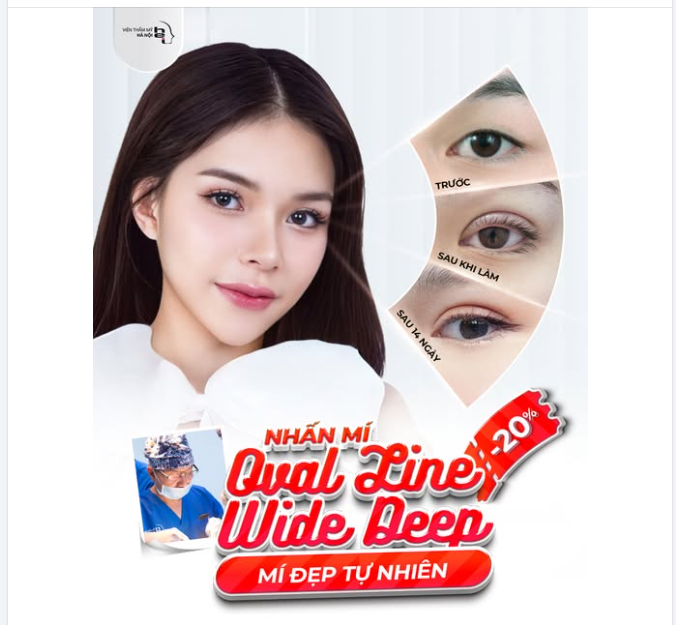 TẠI SAO OVAL LINE WIDE DEEP ĐANG "SOÁN NGÔI" PHƯƠNG PHÁP CẮT MÍ?