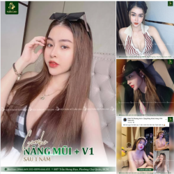 NÂNG MŨI + NÂNG V1 COMBO ĐẸP SANG CHẢNH, QUYẾN RŨ, GỢ.I CẢM!!!