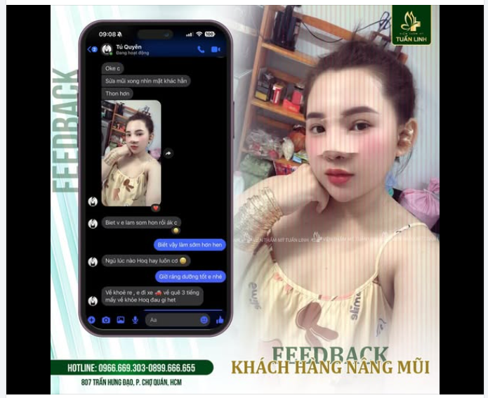 FEEDBACK NÂNG MŨI TỪ KHÁCH HÀNG THẬT 100%!!