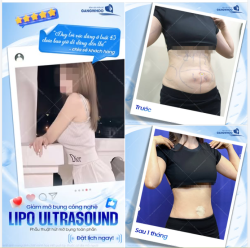 MÓN QUÀ CHO VÓC DÁNG SAU 1 NĂM