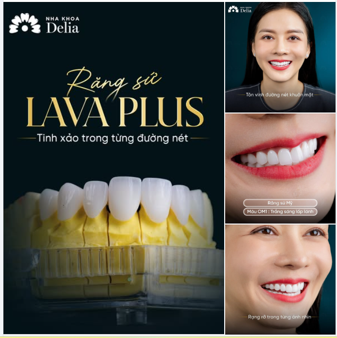RĂNG SỨ LAVA PLUS - TINH TẾ TRONG TỪNG ĐƯỜNG NÉT