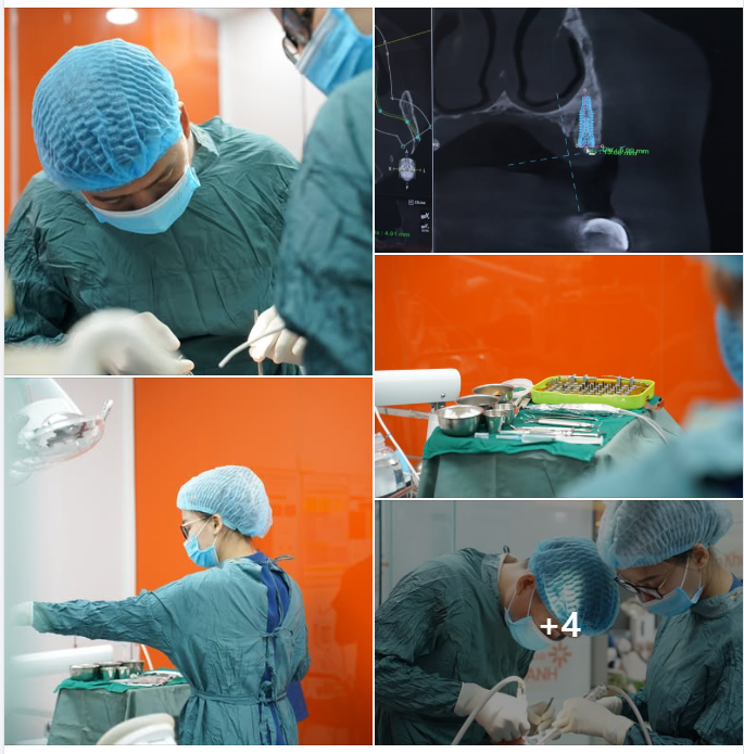 DƯỚI ÁNH ĐÈN PHÒNG PHẪU: NƠI NHỮNG NỤ CƯỜI ĐƯỢC "TÁI SINH"