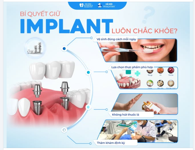 LÀM SAO ĐỂ RĂNG IMPLANT LUÔN "CHẮC KHỎE"?