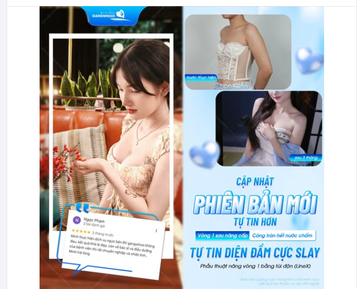 CẬP NHẬT PHIÊN BẢN MỚI TỰ TIN HƠN - VÒNG 1 SAU NÂNG CẤP CĂNG TRÀN HẾT NƯỚC CHẤM, TỰ TIN DIỆN ĐẦM CỰC SLAY