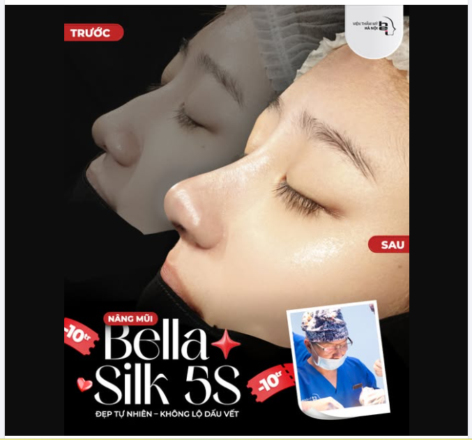 NÂNG MŨI KHÔNG ĐAU – CHỈ CÓ XINH THÔI