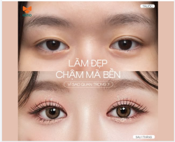 LÀM ĐẸP CHẬM MÀ BỀN, VÌ SAO ĐIỀU ĐÓ QUAN TRỌNG?