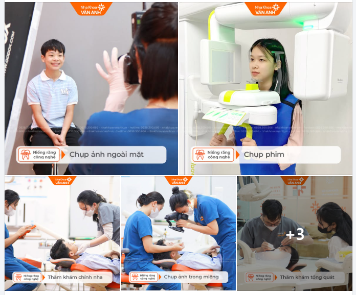 Từ tiêu chuẩn quốc tế đến Nha khoa Vân Anh: Nỗ lực mang đến quy trình thăm khám niềng răng chuẩn mực cho người Việt