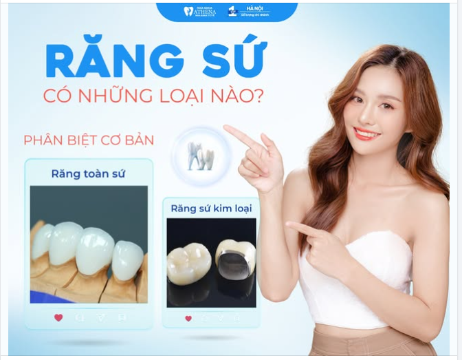 NÊN LÀM RĂNG SỨ LOẠI NÀO