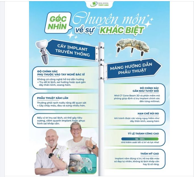 CẤY IMPLANT TRUYỀN THỐNG SỬ DỤNG MÁNG HƯỚNG DẪN PHẪU THUẬT