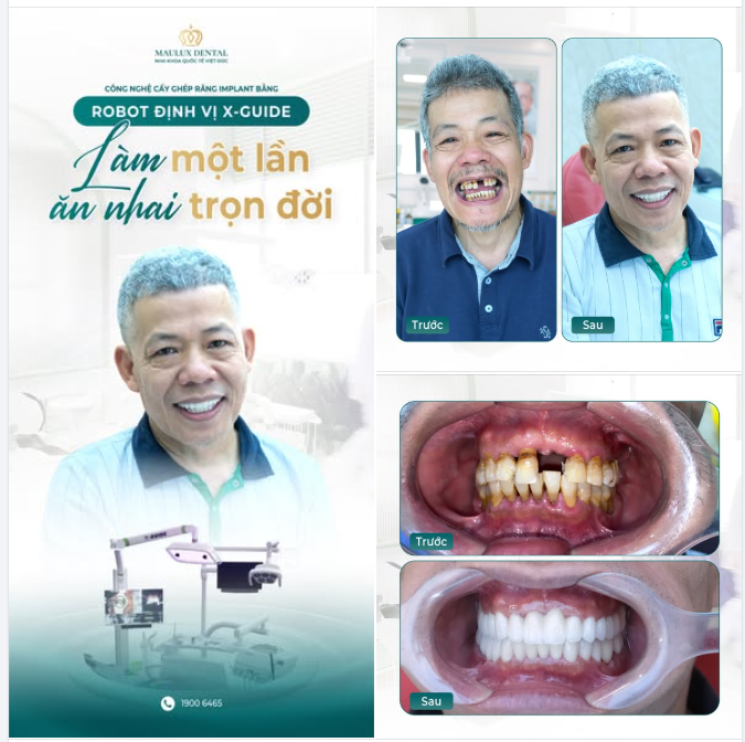 TRỞ VỀ ĐỂ TÌM LẠI NỤ CƯỜI - 1 THÁNG THAY ĐỔI CẢ CHẤT LƯỢNG SỐNG