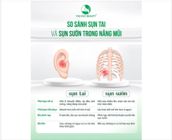 SỤN TAI SỤN SƯỜN TRONG NÂNG MŨI – ĐÂU LÀ LỰA CHỌN PHÙ HỢP?