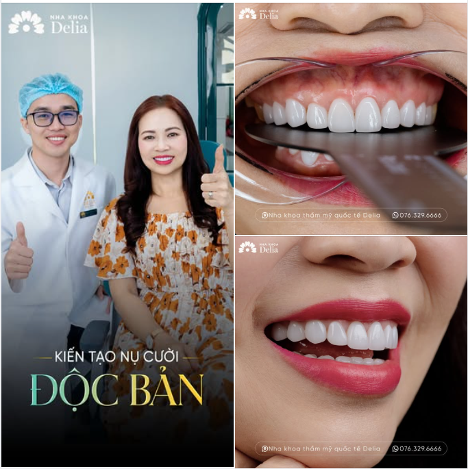 THẨM MỸ RĂNG SỨ ĐÁNH THỨC VẺ ĐẸP TỰ NHIÊN