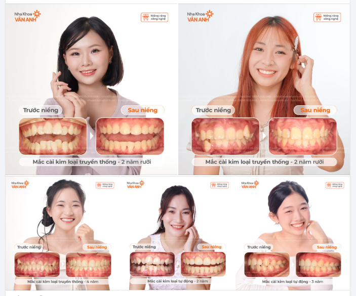 Nụ cười tự tin không tự nhiên mà có