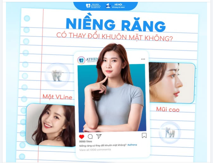 NIỀNG RĂNG KHIẾN MẶT THAY ĐỔI?