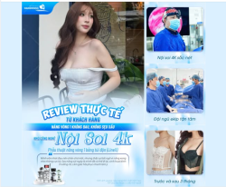 REVIEW THỰC TẾ TỪ KHÁCH HÀNG - NÂNG VÒNG 1 KHÔNG ĐAU, KHÔNG SẸO XẤU NHỜ CÔNG NGHỆ NỘI SOI 4K