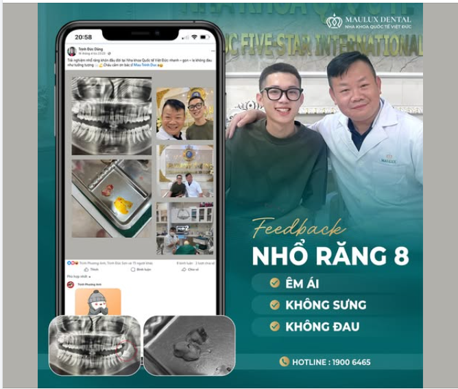 NHỔ RĂNG KHÔN – NHẸ NHÀNG HƠN MÌNH NGHĨ